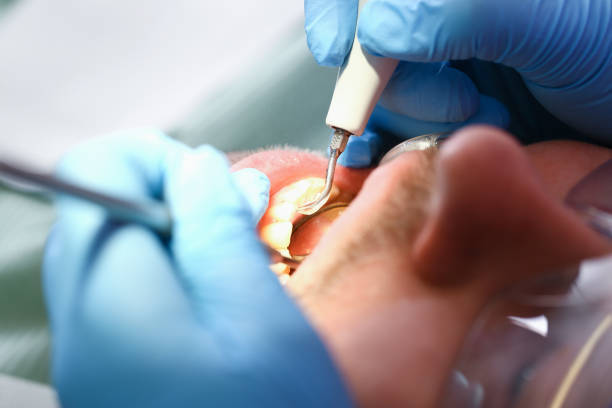 Best Emergency Root Canal Treatment in Shinglehouse, PA